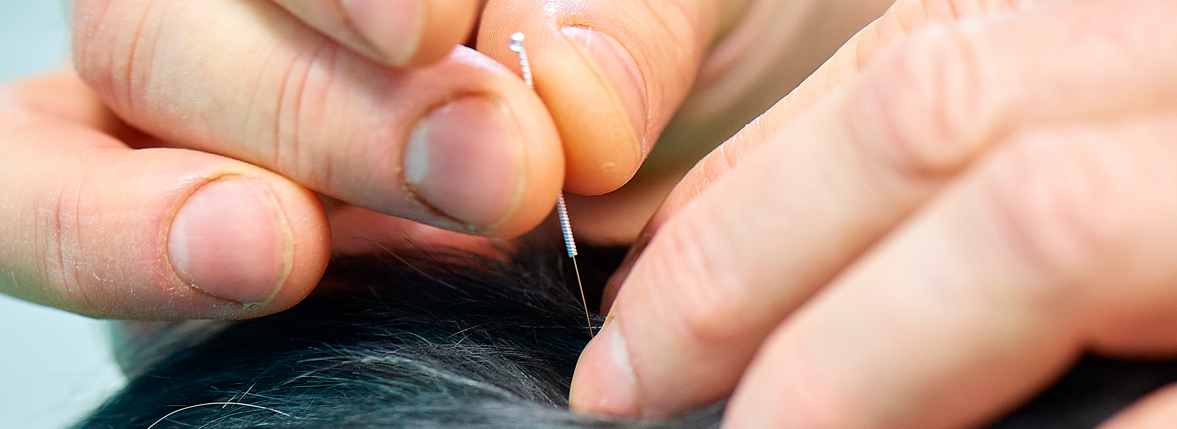 Les Vétérinaires du Bocage, acupuncture pour les animaux-2